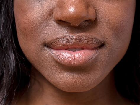 Having that in mind, make sure that the scab you are about to heal is completely dry and not oozing pus or fluids. How to get rid of a cold sore fast? | COMPEED®