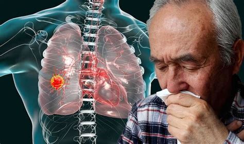 Lung Cancer Coughing Up Blood And Other Signs Get Tested At Your