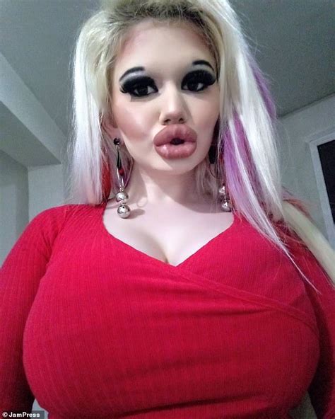 Woman 22 Who Has Spent Thousands Quadrupling The Size Of Her Lips