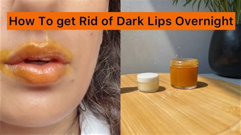How To Lighten Dark Lips Overnight How To Get Rid Of Lip Pigmentation