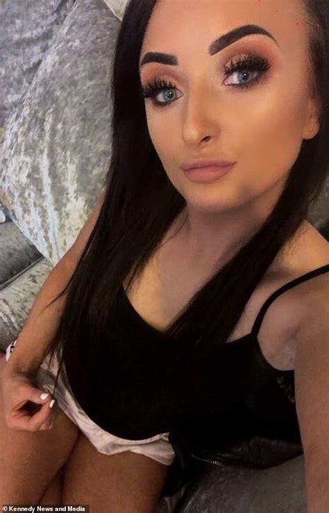 Billie Roocroft Claims A Filler Treatment Made Her Lips Double In Size