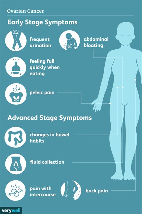 How To Detect Ovarian Cancer Early Heightcounter5