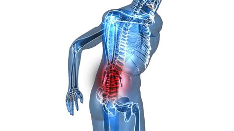 Best Back Pain Relief Products And 5 Best Treatments For ...