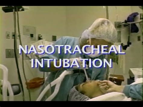 Nasotracheal Intubation Youtube