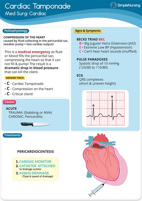 Cardiac Cardiac Tamponade Simple Nursing Nus Dccc Studocu