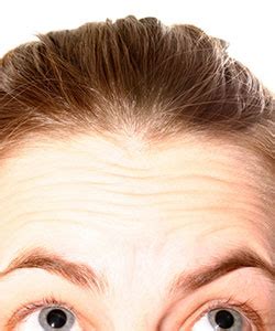 Male and female pattern baldness happens in patterns. Thinning Hair in Woman - Cause and Solution