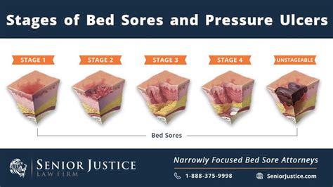 Nursing Home Bed Sore Lawyers Senior Justice Law Firm