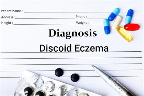 Causes Symptoms And Treatments Of Discoid Eczema Facty Health