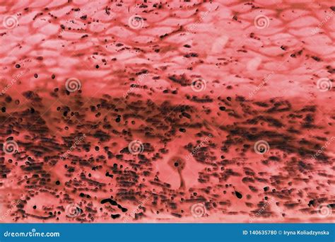 Cancer Cells Under A Microscope Tissues Affected By Cancer Cells Under