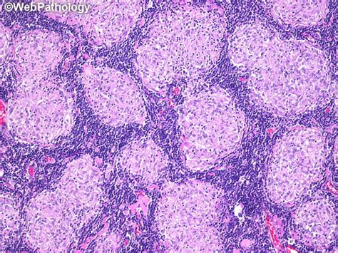 A Collection Of Surgical Pathology Images