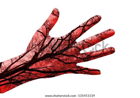 Hand Veins Arteries Evidence Isolated On Stock Photo 535451539