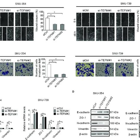 tefm knockdown suppressed hcc cell invasion and migration through download scientific diagram