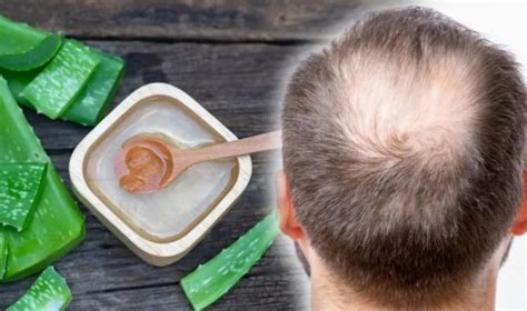 Can Aloe Vera Cause Hair Loss Facts To Know After Sybil