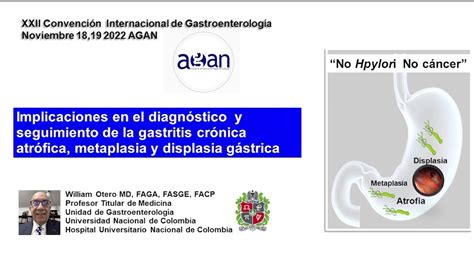 Diagnostico De La Gastritis Cronica Atrofica Metaplasia Y Displasia