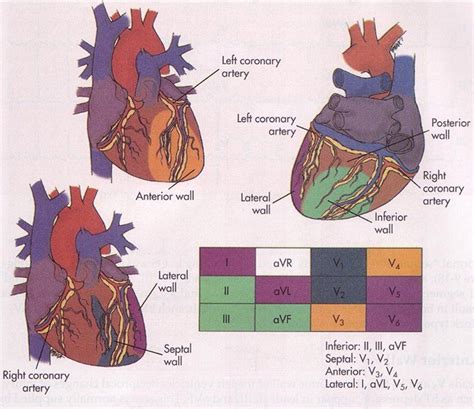 Dérivations Ecg Cardiology Arteries Anatomy Coronary Arteries