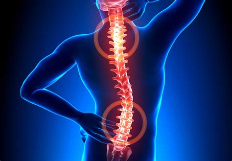 What Is Back Pain What Causes Back Pain Mid Back Pain Headquarter