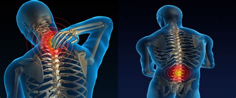 Musculoskeletal Disorder Symptoms