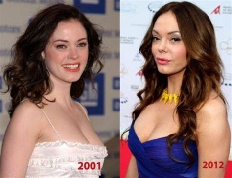 Rose Mcgowan Plastic Surgery Before And After Photos Rose Mcgowan