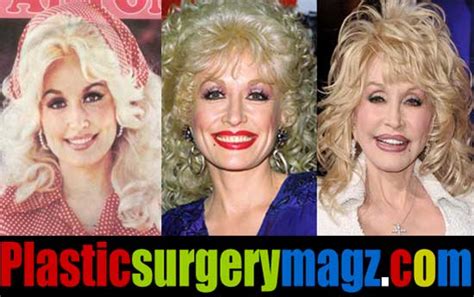 Dolly Parton Plastic Surgery Gone Wrong This Became The Talk Of The