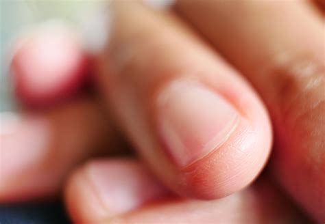 Sans corrosive gel nail polishes, the health of my nails visibly improved. 6 Things Your Nails Say About Your Health - Health ...
