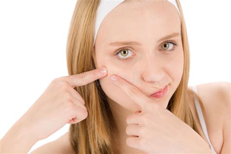 Acne Na Acne Da Dermatologia Facial Da Pele Acne Foto De Stock Imagem De Maxila Corpo 172240070