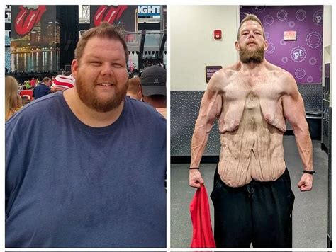 Man Looks Completely Unrecognizable After Losing 336lbs Weight Loss Journey Breaks The Internet
