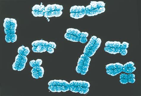 Chromosomeshtml 0102 Humanmitoticchromosomes