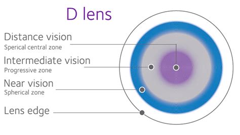 Balanced Progressive Technology Coopervision Canada