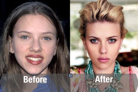 10 Beautiful Female Celebrity Plastic Surgery Transformations