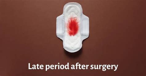 Late Period After Surgery Whats Behind And How To Tackle It