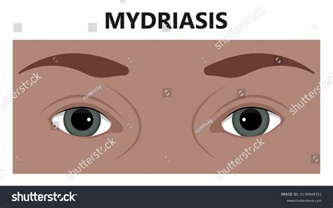 Miosis Eye Pupil Size Iris Retina Stock Vector Royalty Free