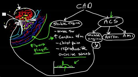 Coronary Heart Disease Pathophysiology Diagram Pelajaran