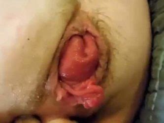 Prolapse Mature BBW Anal Slave Awesome Anal Rosebutt Stretched With