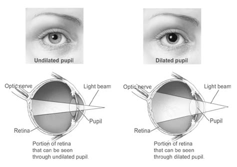 Refraction In The Eye