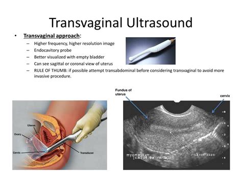ppt ultrasound basics in obstetrics powerpoint presentation free download id 6234767