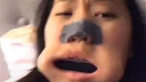 Tiktok Video Goes Viral After Canadian Teenager Gets Harmonica Stuck