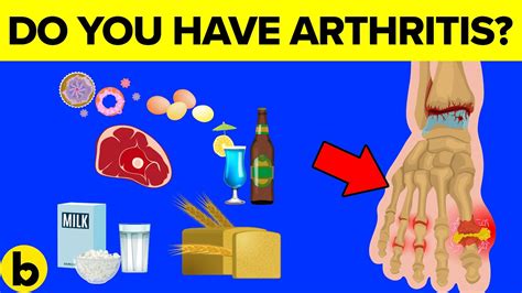 What is apixaban and how does it work? 10 Foods To Avoid If You Have Arthritis - YouTube