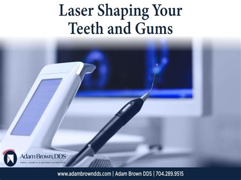 Laser Shaping Your Teeth And Gums Adam Brown Dentistry Monroe Nc