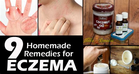 How To Get Rid Of Eczema Fast