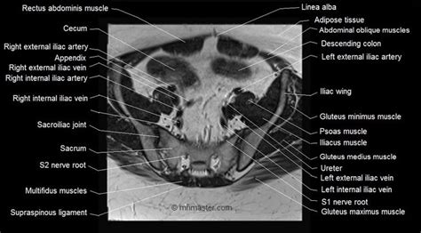 Mri Female Pelvis Anatomy Axial Image 6 Pelvis Anatomy Pelvis