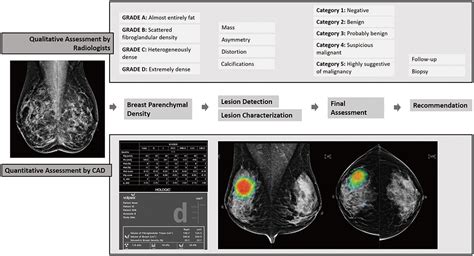 Deep Learning Based Artificial Intelligence For Mammography
