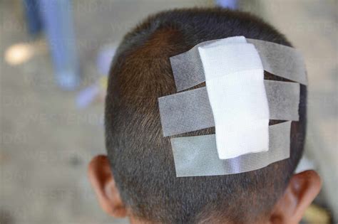 Close Up Of Boy With Bandage On Head Stock Photo