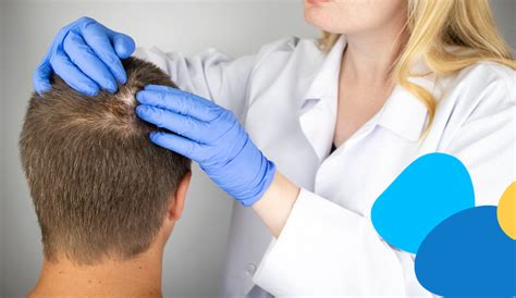 Alopecia Cosè Tipologie Cause E Sintomi Doctolib
