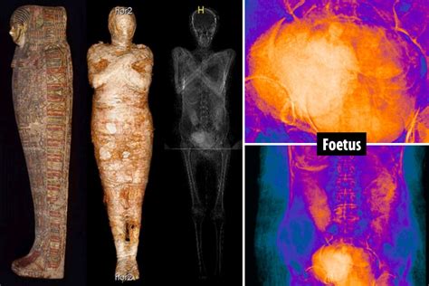 Worlds First Pregnant Ancient Egyptian Mummy Identified By Scientists