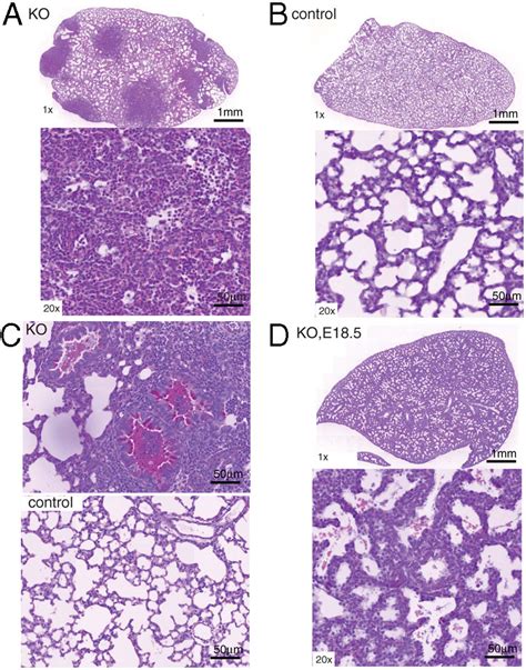 Severe Inflammation And Airway Mucus Accumulation In Lungs Of Nedd4l