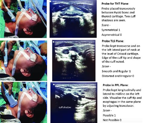 Figure Showing The Three Planes In Which Ultrasound Airway Examination