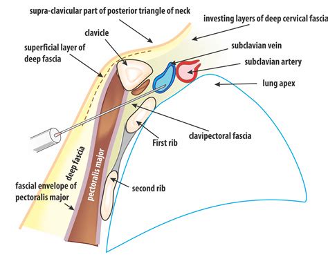 What part of the sternum is involved in the sternoclavicular articulation? Anatomical Considerations for Creating the Pacemaker ...