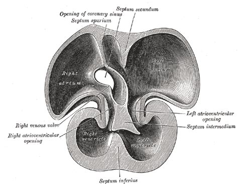 Interventricular Septum Wikidoc