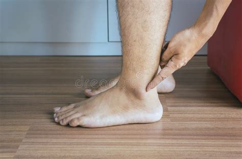 Man Dry Skin Or Pigmentation On Feet With Ankleboneclose Upskin