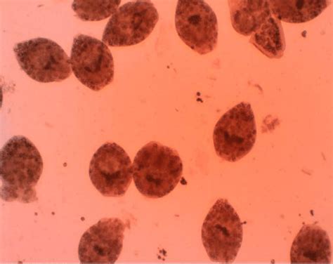 Dead Protoscolece Of Hydatid Cysts After Exposure To Nsativa With 01